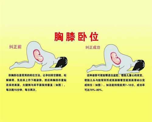 女性朋友警惕宫颈疾病暗算：台州代孕成功率
